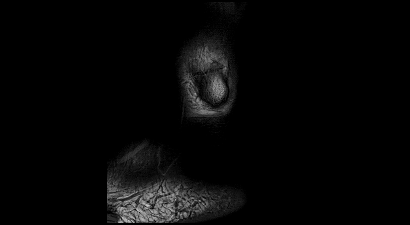 MRI ankle ligaments anatomy sagittal 3T image 28.webp